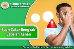 Buah Zakar Bengkak Sebelah Kanan